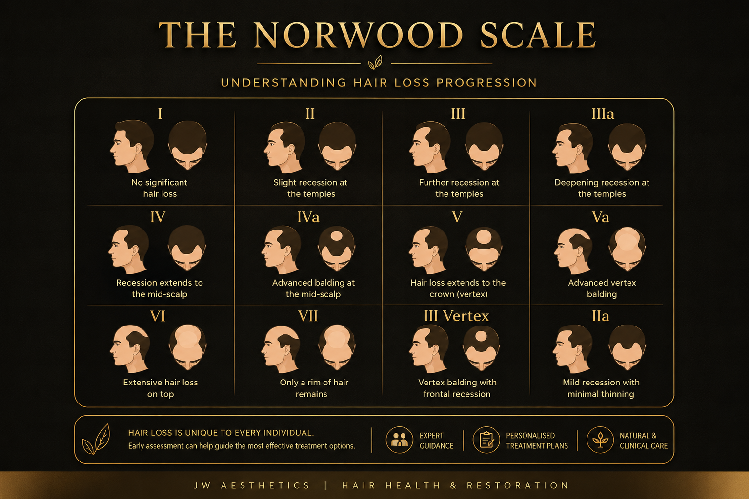 Norwood Scale guide for hair loss progression